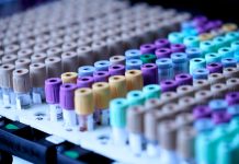 PCR (Covid-19) Testing in Istanbul: Laboratories, Prices, & Experiences