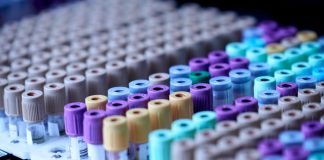 PCR (Covid-19) Testing in Istanbul: Laboratories, Prices, & Experiences